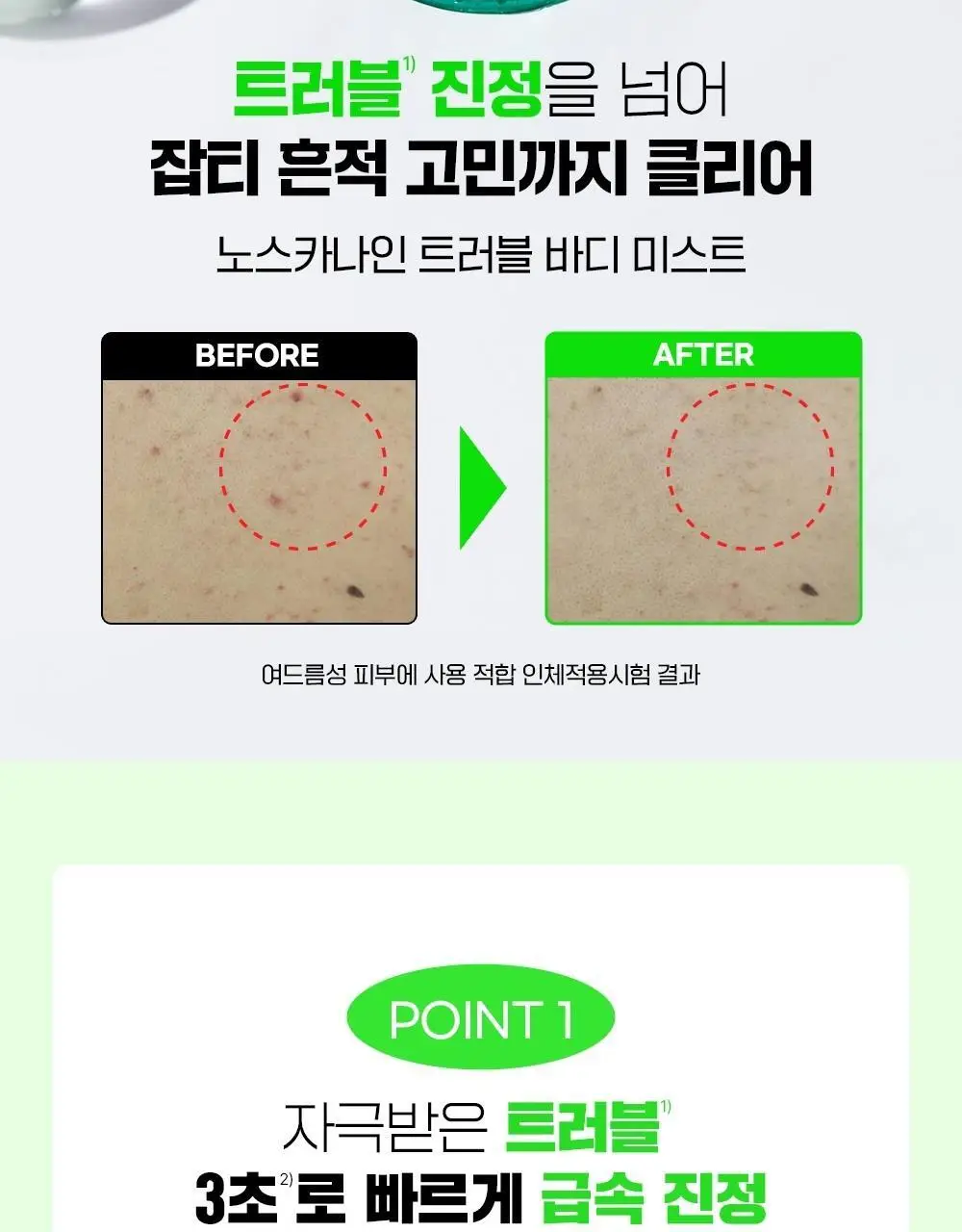 [트러블진정흔적] 파티온 노스카나인 트러블 바디 미스트 145ml 상세페이지 3
